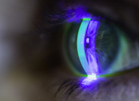 Traumatisme oculaire